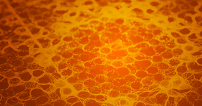 Case Stories Resource Thumb 9